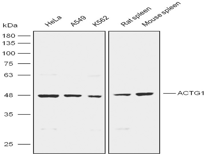 Anti-ACTG1 Polyclonal Antibody抗體